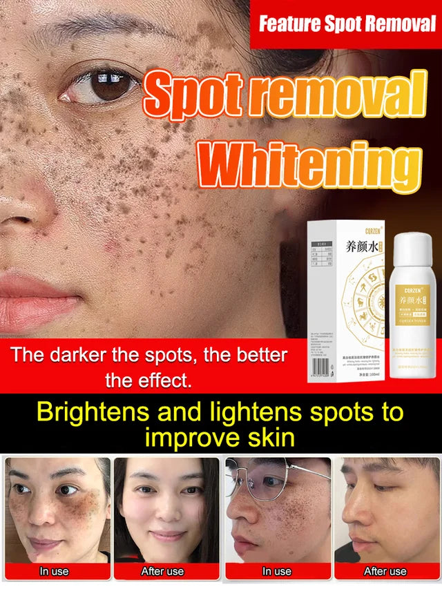 Dark Spot Corrector 🔥Hot Sales Now 50% OFF🔥🎉
