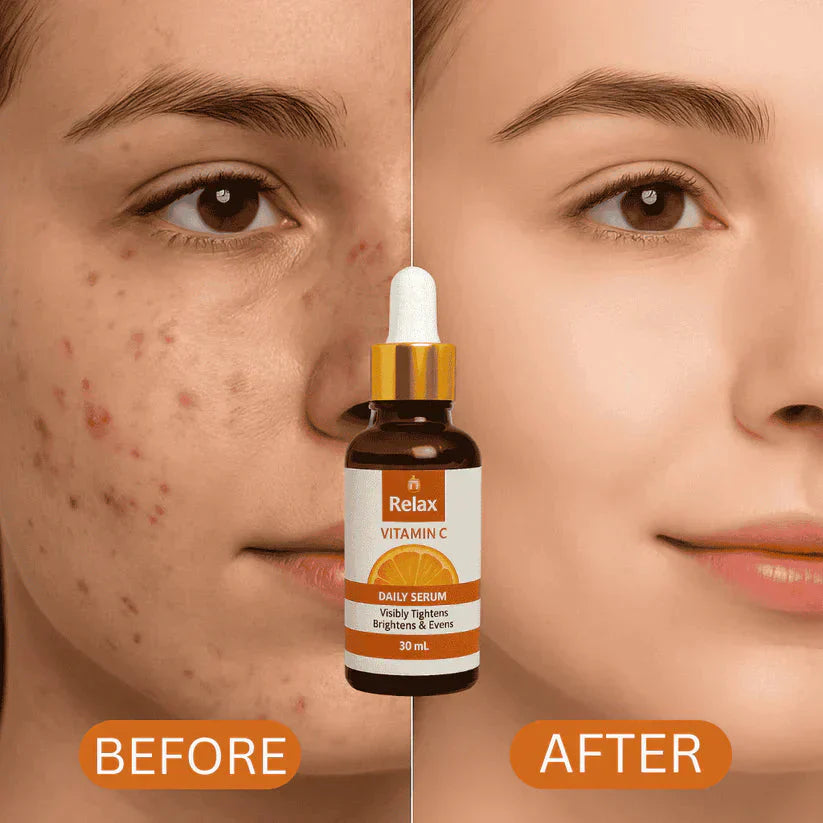 Relax Vitamin C Face Serum