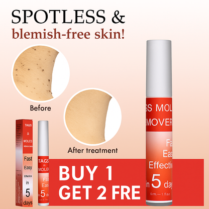 LOVILDS™ Tags & Moles Remover