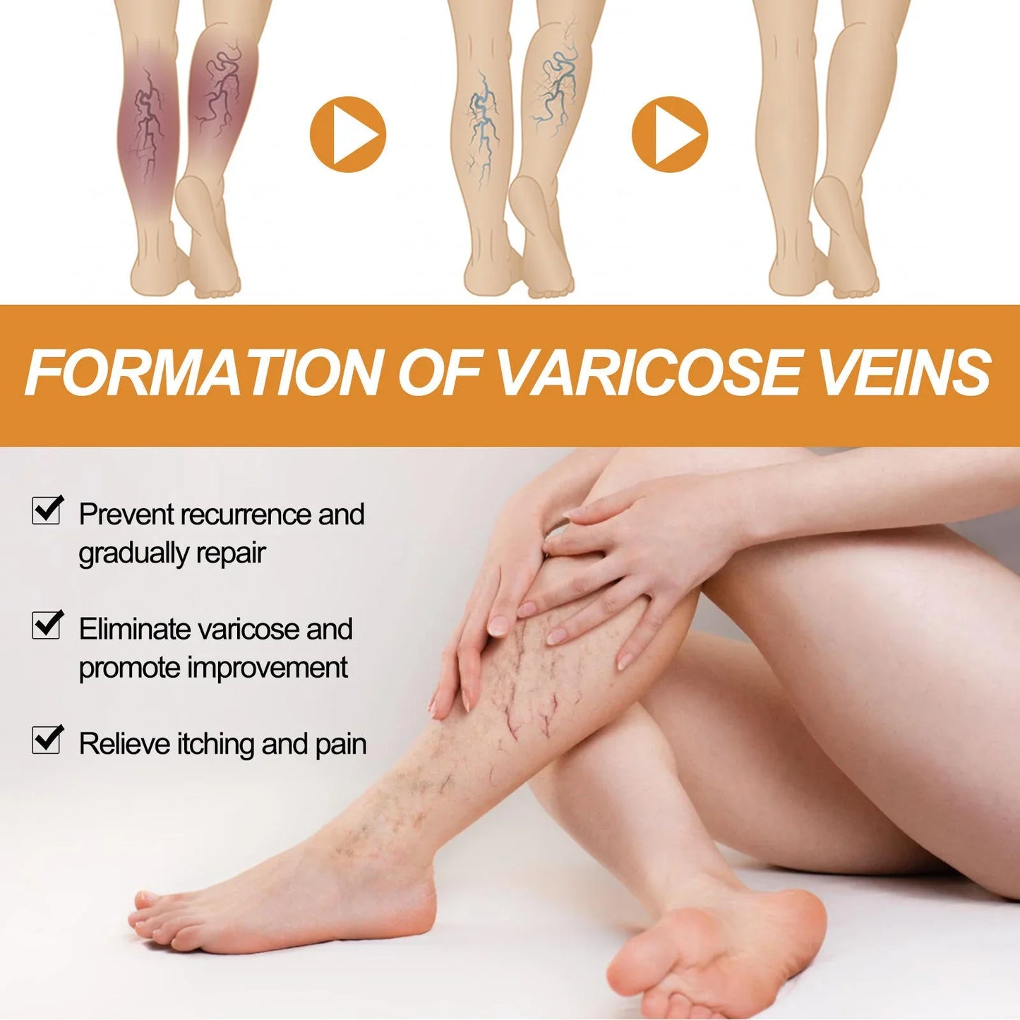 Turmeric Varicose Vein Relief