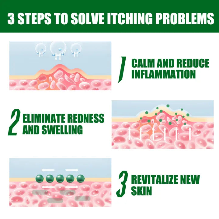 South Moon Eczema Cream