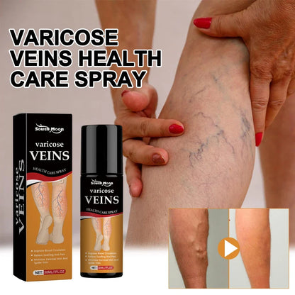 Turmeric Varicose Vein Relief