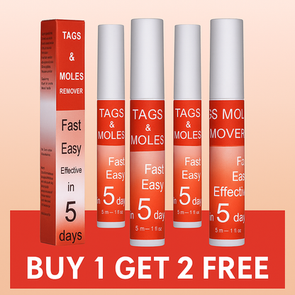 LOVILDS™ Tags & Moles Remover